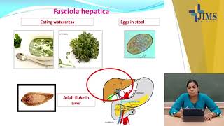 Topic  Trematodes  Part I [upl. by Parke]