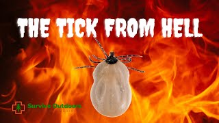 TICK BITE Case Study Ehrlichia Chaffeensis [upl. by Maryl]