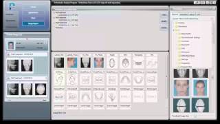 01 Basic Introductory Instructional Tutorial Video For OrthoVision [upl. by Robinetta]