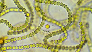 Nostoc commune  the nitrogen fixing cyanobacterium [upl. by Lasiaf]