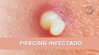 Piercing Infectado ¿Cómo saber si mi perforación esta infectada [upl. by Sorilda944]