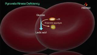 Pyruvate kinase deficiency [upl. by Eirruc]