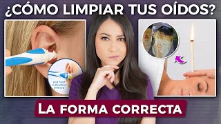 Esta es la forma CORRECTA de limpiar tus oídos 👩🏻‍⚕️l ¿Cotonetes ¿Conoterapia [upl. by Arleyne]