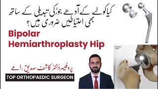 What is Bipolar Hemiarthroplasty Hip [upl. by Sansen]