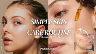 The Simple Skin Care Routine that Cleared Acne  Payton George [upl. by Euqcaj]