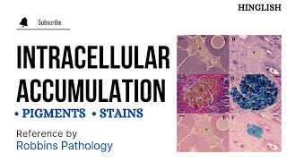 Intracellular Accumulations  Pathology  KTC MBBS [upl. by Eldora]