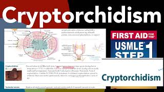 Cryptorchidism in HindiUrdu by first aid for USMLE step 1 [upl. by Dillie]