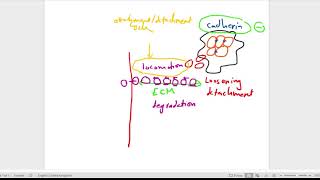 neoplasia lecture 7 part 2 [upl. by Hebert]