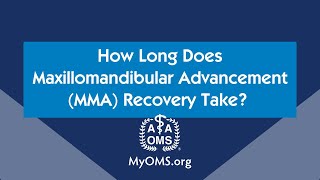 How Long Does Maxillomandibular Advancement MMA Recovery Take [upl. by Saxon623]