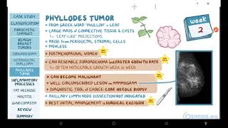 Benign breast conditions  pathology review  Osmosis [upl. by Feer]