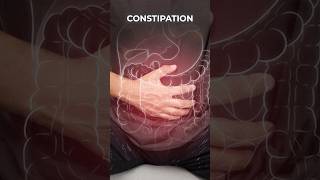 How constipation becomes a big problem for varicose veins and varicocele Simple solution here [upl. by Leod]