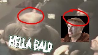 FAZE BANKS IS BALD PART 22 fazebanksbald [upl. by Rosalee914]