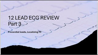 12 Lead ECG Review Part 3 Localizing MI [upl. by Iemaj]