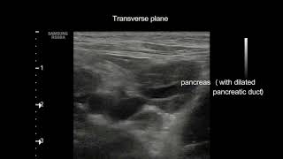 Extrahepatic cholestasis in a cat [upl. by Nossaj3]