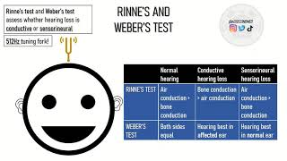 58 SECONDS on RINNES TEST and WEBERS TEST Concise explanation [upl. by Livvi]