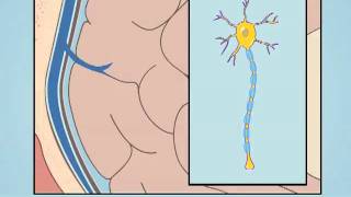 Understanding Diffuse Axonal Injury [upl. by Stanly]