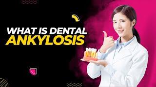 What is Dental Ankylosis 5 Symptoms You Should Know [upl. by Hart]