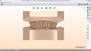 How to Prepare Orthodontic Models Set Virtual Models Bases [upl. by Aramal]