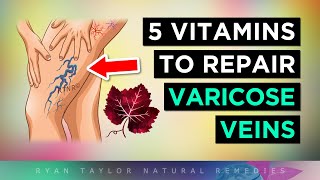 5 Vitamins For Venous Insufficiency VARICOSE Veins Remedies [upl. by Gerhardt]