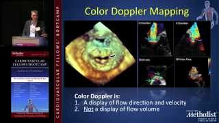 EchoDoppler Stephen H Little MD [upl. by Arvind734]