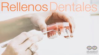 Así se hacen los Rellenos Dentales con Resina [upl. by Lorenza]