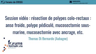 Session vidéo  résection de polypes colorectaux  Thomas Di Bernardo [upl. by Dustman]