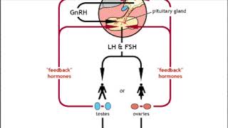 Kallmann syndrome amp CHH Basic treatment options [upl. by Ignacia]