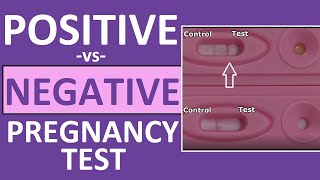 Positive Pregnancy Test – Accuracy Result amp What to Expect Next [upl. by Denna672]