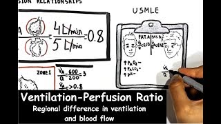 VentilationPerfusion Ratio Regional Difference In Ventilation And Blood Flow [upl. by Trauts300]