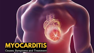 Myocarditis Causes Signs and Symptoms Diagnosis Treatment [upl. by Raskin]