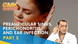 Preauricular Sinus Perichondritis and Ear Infection Part 3  Usapang Pangkalusugan [upl. by Quill329]