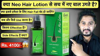 Neo Hair Lotion for Hair Fall Usage Benefits Side Effects Result l Detailed Review [upl. by Suolkcin]