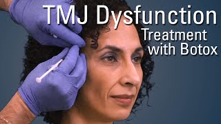 TMJ Dysfunction Treatment with Botox®  Sneak Preview [upl. by Airenahs]