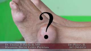 What is Gout 6 [upl. by Sakhuja]