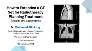 How to Extended a CT Set for Radiotherapy Planning Treatment [upl. by Conah70]