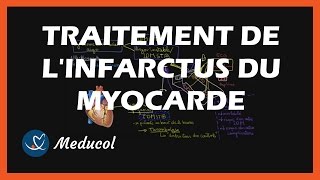 Traitement infarctus du myocarde  médicaments de lurgence thrombolyse et traitement au long cours [upl. by Merriott154]