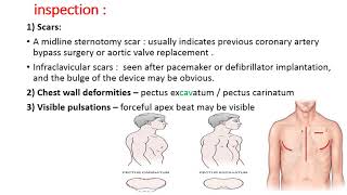 CS 2 CARDIOVASCULAR EXAMINATION  Precordium  by Dr Zaid [upl. by Enialed]