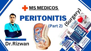 Peritonitis Part 2SurgeryMS MedicosDr RizwanUrdu Hindi Easy Explanations [upl. by Letney603]