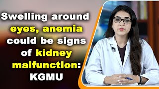 Swelling around eyes anaemia could be signs of kidney malfunction KGMU [upl. by Jempty732]