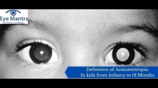 Anisometropia  Symptoms and Causes  Diagnosis  Treatment  Prevention [upl. by Valorie818]