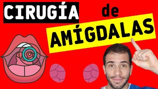 ✅ Cirugía de amígdalas AMIGDALECTOMÍA 👄 ¿Cuáles son los riesgos y complicaciones [upl. by Birck181]