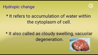 Hydropic change pathology  morphology of reversible cell injury part1 [upl. by Denae264]