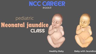 Pediatric Neonatal Jaundice class  2024 [upl. by Ydnic]