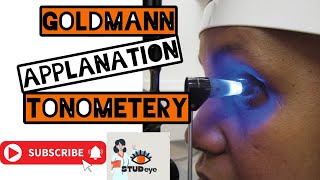 Goldmann Applanation Tonometer  Tonometry [upl. by Enilatan]