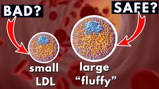 LDL size and Heart Disease small dense vs large quotfluffyquot  Dr William Cromwell [upl. by Nnod]