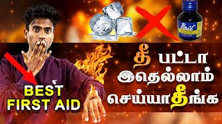 First aid for burn  How to treat burn  Basic first aid tips [upl. by Xylon]