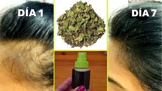 Recupera cabello de LAS SIENES y zonas despobladas con esta receta💪🟢Cabello fortalecido y sin caída [upl. by Jedediah]