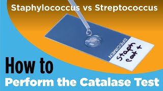 How to Perform the Catalase Test  Staphylococcus vs Streptococcus [upl. by Adnohsar]