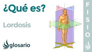 LORDOSIS  Qué es por qué se produce cuáles son sus síntomas y a quién afecta [upl. by Buchbinder]