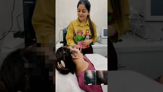 Hair growth treatments  Client Review  beautbyharleen [upl. by Otir]